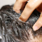 Успокаивающий пилинг для кожи головы СР-1 Head Spa Pink Salt Scalp Scaler — изображение 3